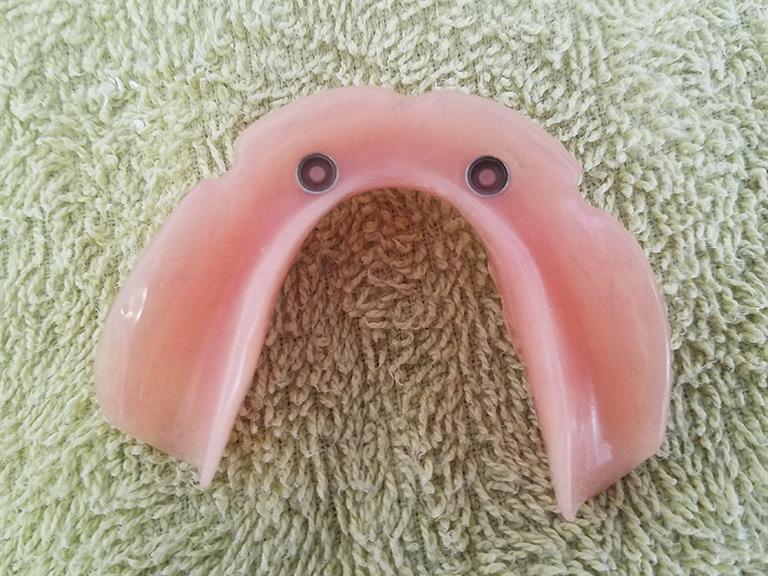 Dentures