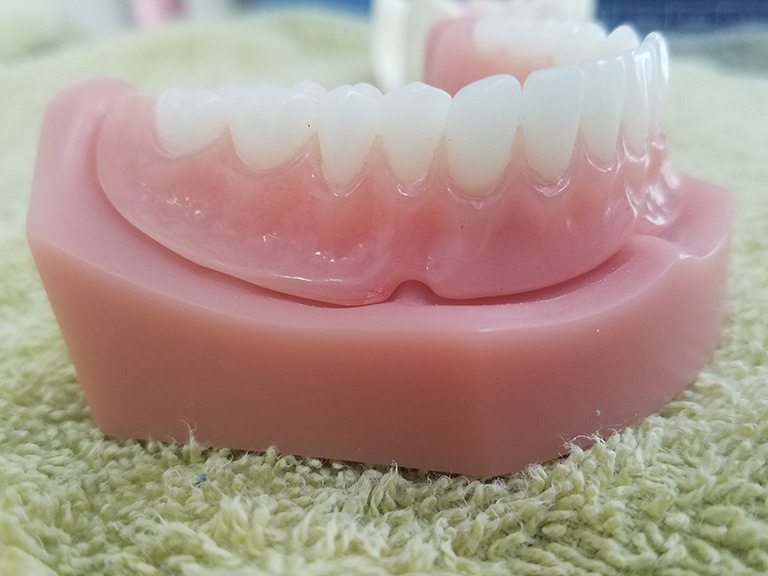 Dentures